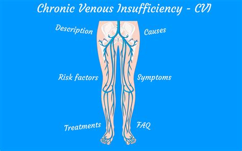 Chronic Venous Insufficiency Cvi Treatments Symptoms Causes