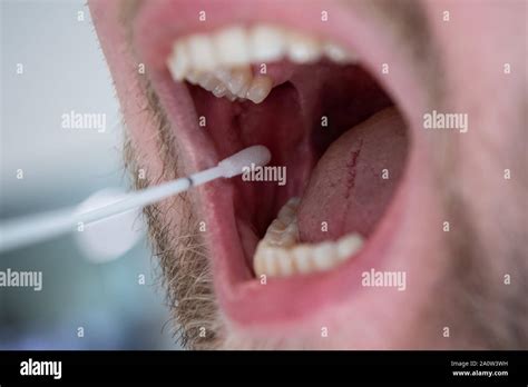 Mucosa Oral Fotografías E Imágenes De Alta Resolución Alamy