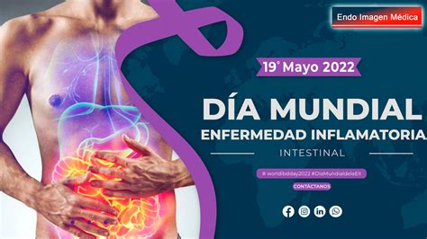 Día Mundial de la Enfermedad Inflamatoria Intestinal Endo Imagen Médica