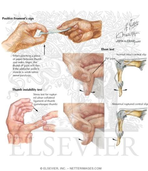 Physical Examination Of The Hand