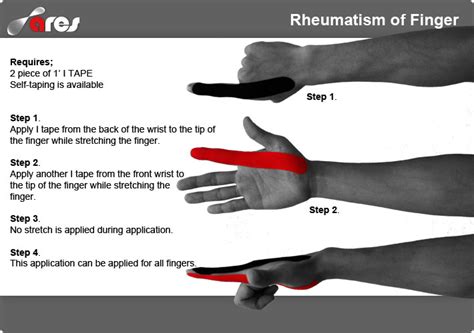 Pin On Kinesiology Taping Instructions