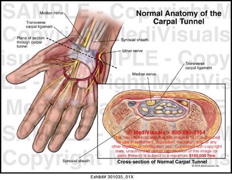 Normal Anatomy Of The Carpal Tunnel Medical Illustration