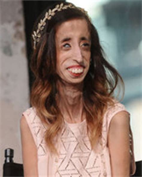 Video How Being Called Ugliest Woman Changed Lizzie Velasquez S Life