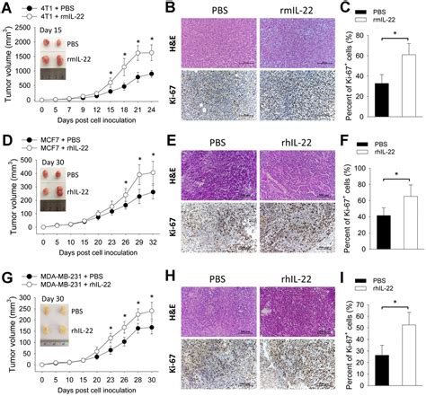 Il Promotes Tumor Growth Of Breast Cancer Cells In Mice Figure F