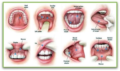Many symptoms caused by oral tumors may be due to other, less serious conditions or other cancers. Oral Cancer - Smile Sensations Centre for Whole Health 613 ...
