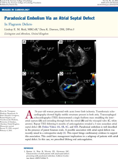 Paradoxical Embolism Via An Atrial Septal Defect In Flagrante Delicto