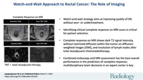 Watch And Wait Approach To Rectal Cancer The Role Of Imaging Radiology