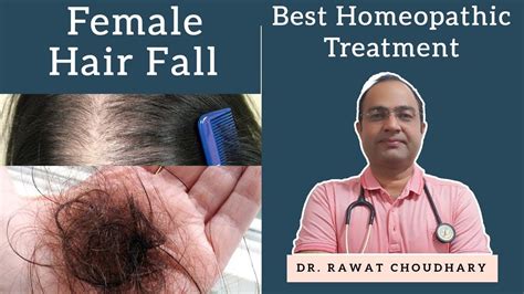 Details More Than Fluoric Acid Homeopathy Hair Loss Best In Eteachers