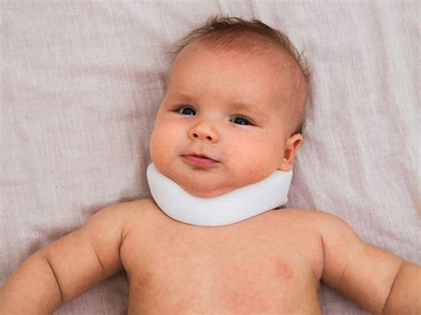 Torticollis Symptoms Causes Types And Other Risk Factors