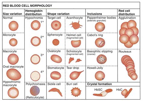 Summary Of Abnormal Red Blood Cell Morphologies And Disease States