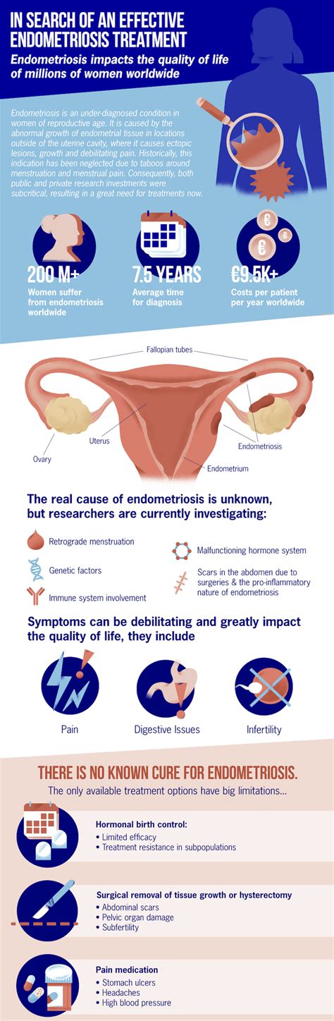 Treatment approaches to endometriosis still remain elusive. Infographic: How Can We Find an Effective Endometriosis ...