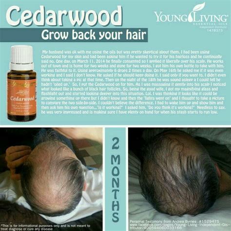 There are many ways you can use cedarwood essential oil to treat your hair loss or thinning hair. Pin on Essential Oils
