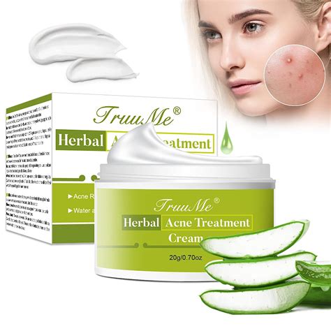 Acne Cream Anti Pimple Cream Acne Remover Cream 20 G Amazonde Beauty