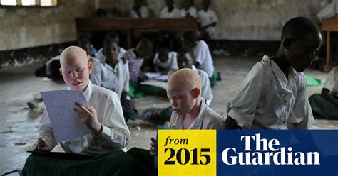 Tanzania Police Arrest 32 Witch Doctors Over Ritual Albino Killings