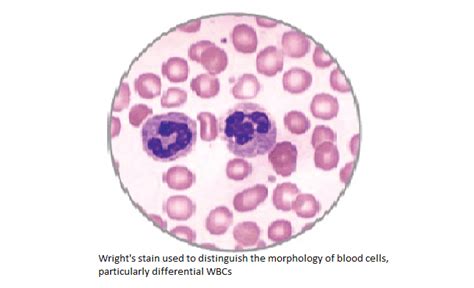 Wrights Stain Procedure Principle And Results Laboratoryintern