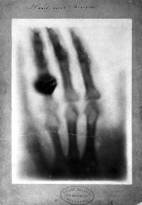 I Have Seen My Death The First X Ray Photograph