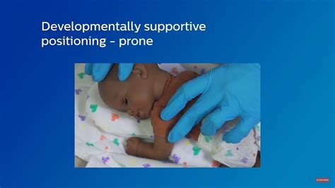 Developmentally Supportive Infant Positioning Prone Youtube