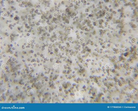 Candida Albicans Under The Microscope Stock Afbeelding Image Of Groei Biologie 177868265