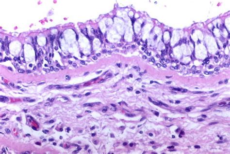 Sie variieren in der größe und können bis zu 50 um lang sein. Bronchial goblet cell hyperplasia (histology) - DocCheck ...