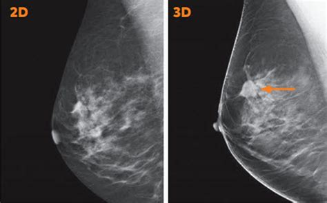 Mammography And Breast Imaging Workflows — Dicom Systems