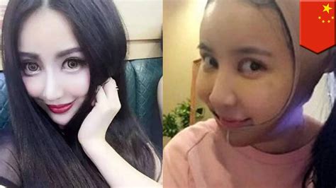 Plastic Surgery Gone Wrong Chinese Girl Yu Bing Has Operations To Look Like Fan Bingbing