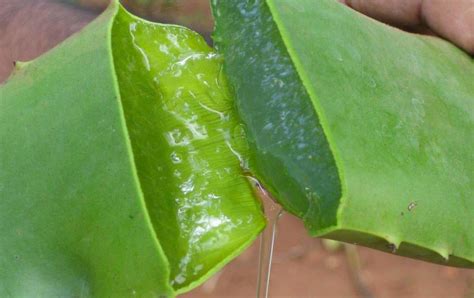 Ia merupakan sebuah rawatan penegangan kulit yang dipanggil thread lift. Petua Tegangkan Kulit Muka Dengan Lidah Buaya - Petua Sejagat