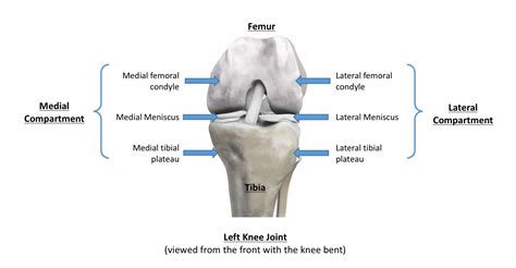 Total Knee Replacements Knee Replacements In London
