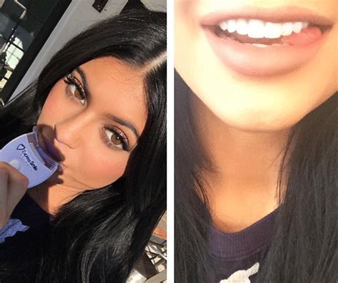 kylie jenner says she s over her big lips look