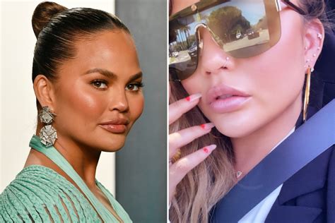 Chrissy Teigen Says You Only Live Once In New Selfie After Model