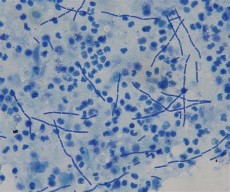 Actinomyces Sp No Preventivo