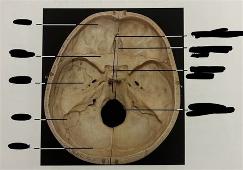 Human Skull Floor Of The Cranium Diagram Quizlet