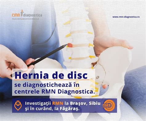Hernia De Disc Se Diagnosticheaz N Centrele Rmn Diagnostica Rmn