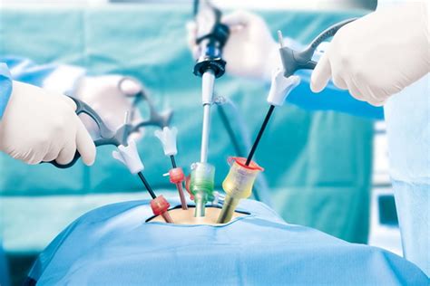 Why Should You Opt For A Laparoscopic Surgery St Elizabeth Hospital