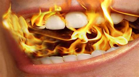 Burning Mouth Syndrome Dental Treatment Options