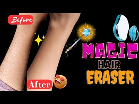 Magic Hair Remover Is A Magical Hair Removal Scam Or Legit Aqsa S