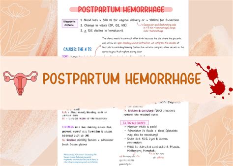 Postpartum Hemorrhage Free Cheat Sheet Lecturio Nursing Hot Sex Picture