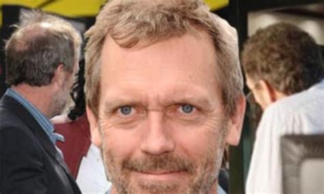 I've seen video of him on the red carpet and various magazines i guess even celebrities have trouble with hair loss. Hugh Laurie has a full head of hair on his TV drama... but ...