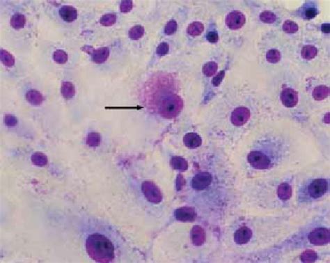 Bacterial Cytoplasmic Inclusions Arrow In Vero Cell Cultures 72 H