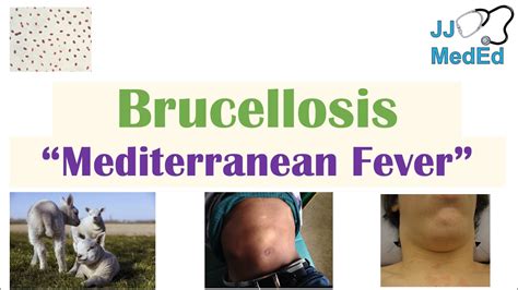 Brucellosis Mediterranean Fever Transmission Pathogenesis