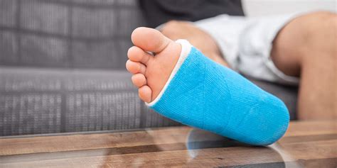 How Long Does It Take To Recover From A Dislocated Ankle