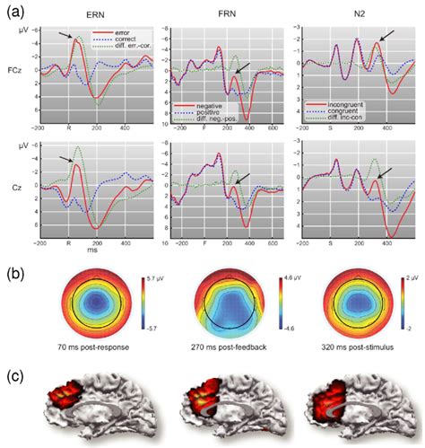 Manifestation Of Error Related Potentials In Eeg And Fmri Data A Download Scientific Diagram