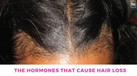 Which Hormones Are Responsible For Boosting Hair