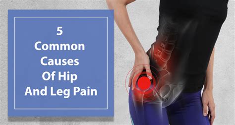 5 Common Causes Of Hip And Leg Pain That Cause You Discomfort