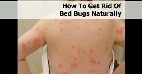 get rid of bed bugs | helpful hints | Pinterest | Helpful hints