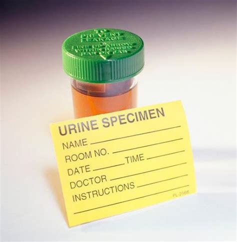 Top 8 Leukocytes In Urine During Pregnancy 2022