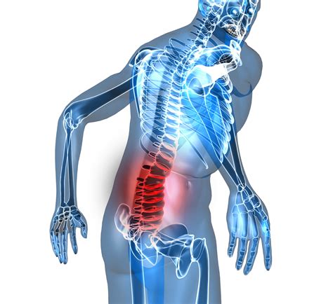 Neurophysiological Pain-education for Patients with Chronic Low Back ...