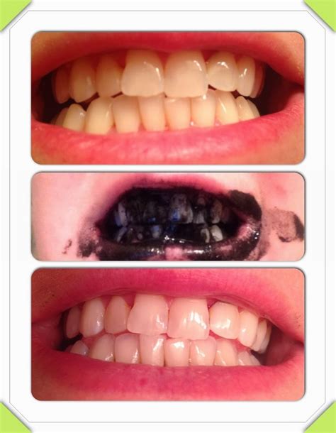 However, what is good for the others may not works well on you. How to Naturally Whiten Your Teeth - DIY - AllDayChic
