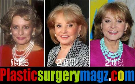 Barbara Eden Plastic Surgery Photos Plastic Surgery Magazine 56700