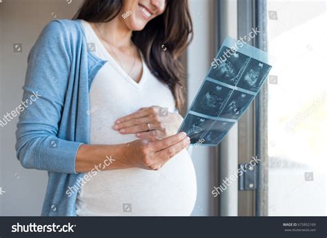 730 Xray Of Pregnancy Stock Photos Images And Photography Shutterstock