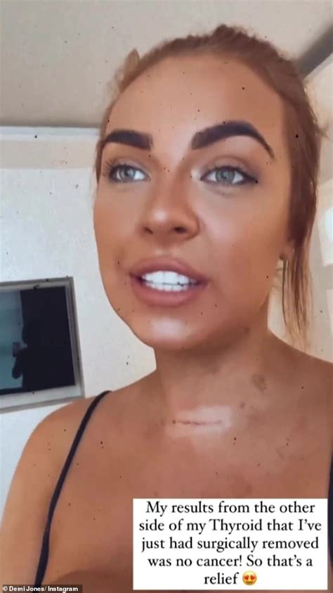 Demi Jones Reveals Her Neck Scar As She Shares Amazing News About Her